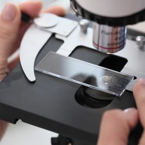 Granactive Retinoid, formă superioară de retinol, pentru tratarea acneei și reducerea semnelor îmbătrânirii