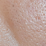 Grasă